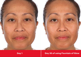 Before and after comparison of a woman's face using Fountain of Glow, with text indicating 'Day 1' and 'Day 30'.