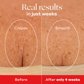 Bright and Tight Kit