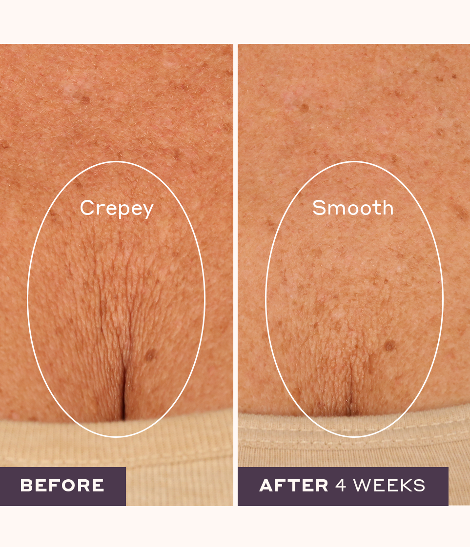 Tight and Smooth Skincare Kit