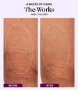 The Works body cream before and after result on the knee area after 4 weeks of use.